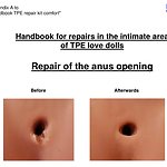 Appendix A - Repair of the anus opening - Indigo Individual TPE Repair Kit ›comf