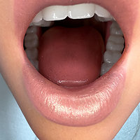 Zelex - Mouth cavity of updated Inspirational Series heads (as of 09/2022)